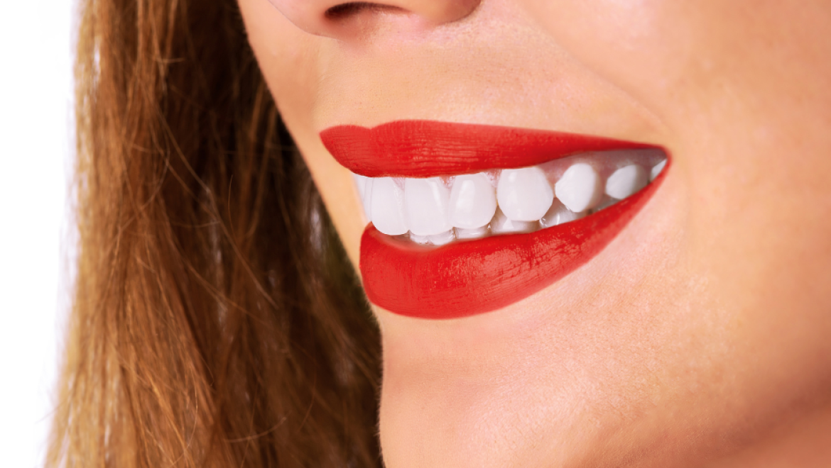האם ניתן לעשות הלבנת שיניים טבעית?